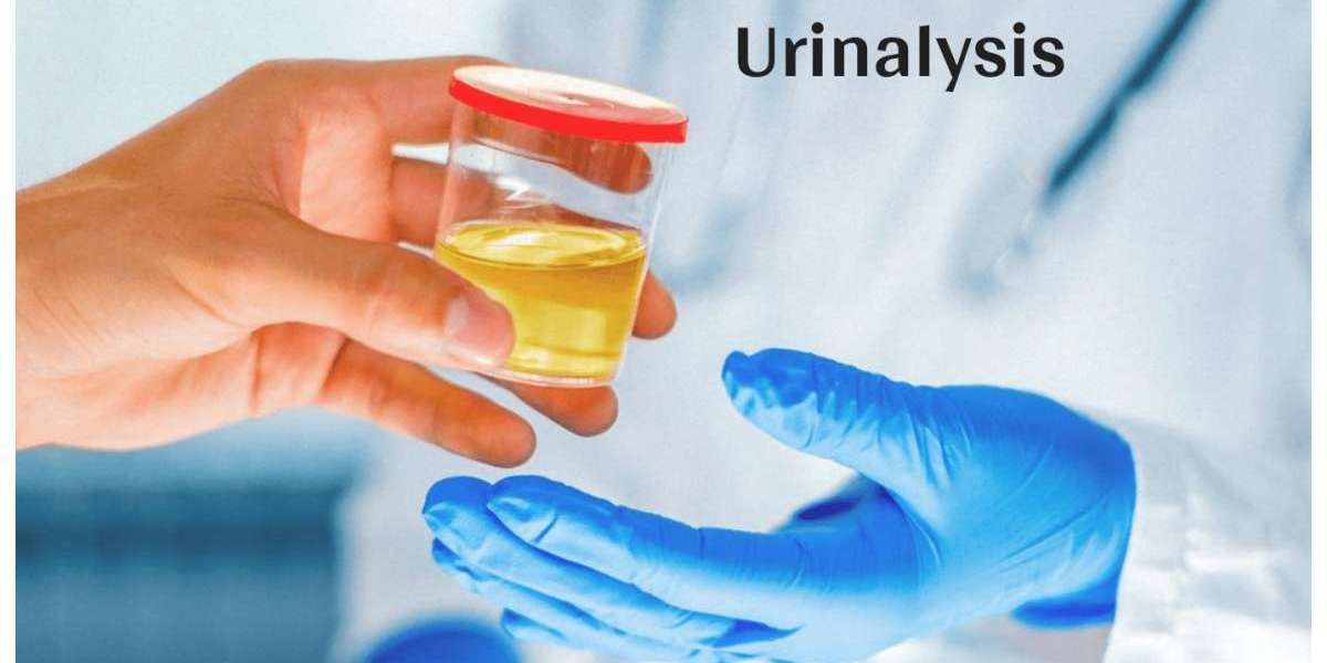 Urinalysis Market: Trends, Forecasts, and Growth Drivers by 2028