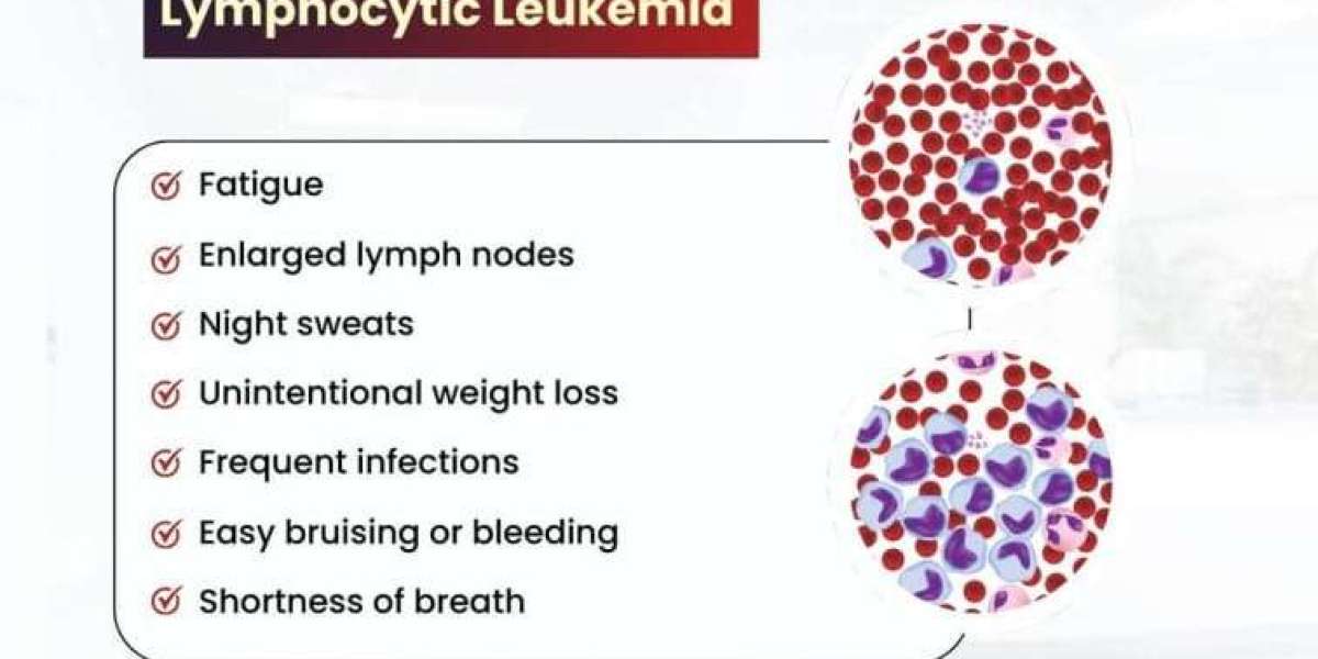 Expert Care for Leukemia: Dr. S.K. Gupta, Renowned Leukemia Specialist