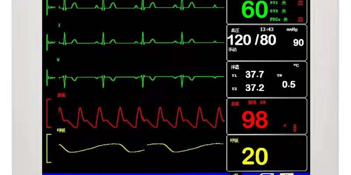 What are the main parameters of the SpO Monitor