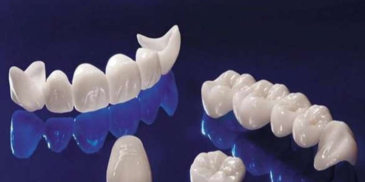 Hỏi đáp: Làm răng sứ ở đâu tốt nhất?