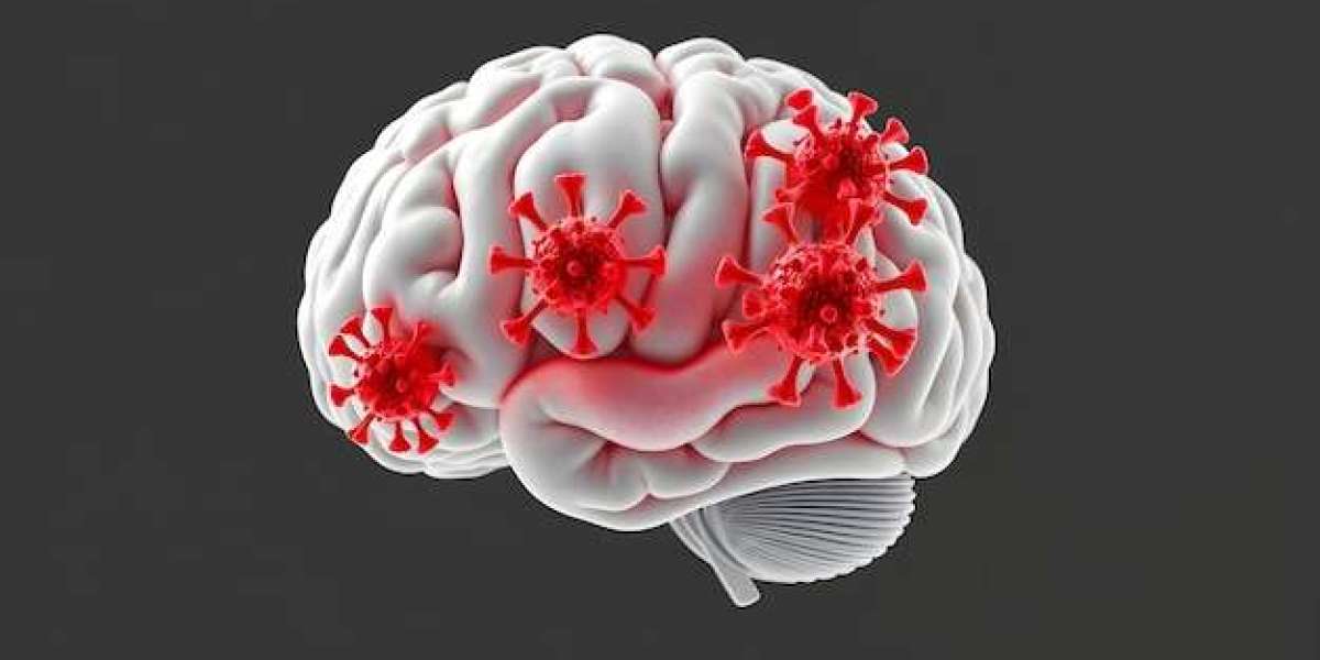Tuberculous Meningitis Market Acceleration: Advanced Therapeutics and Strategic Market Expansion