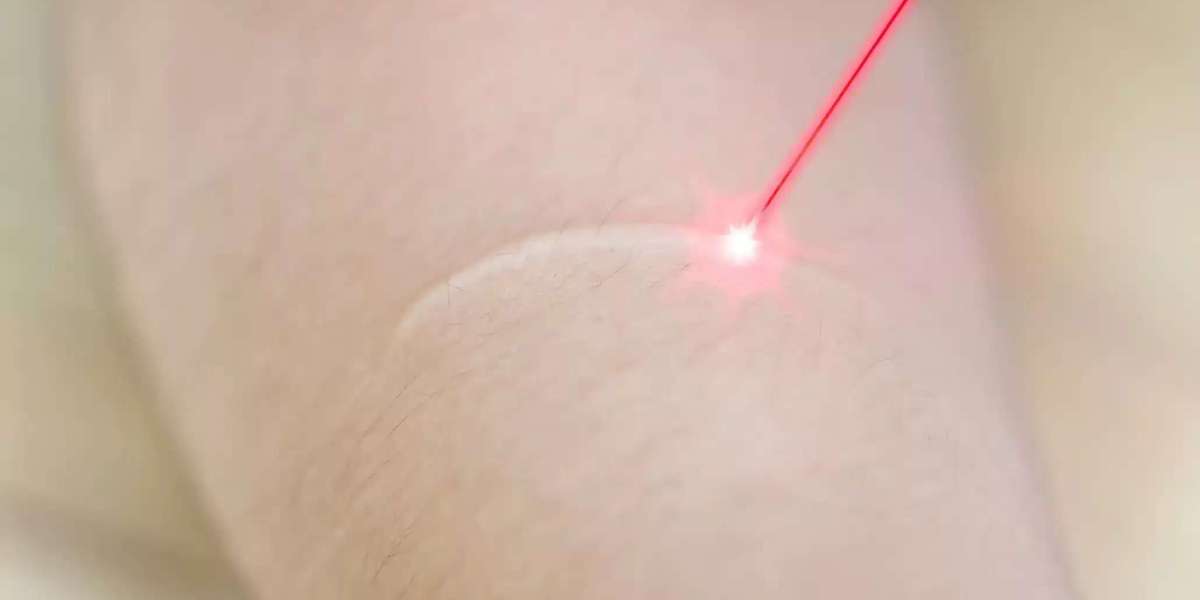Clear Skin & Healthy Nails: Discover Advanced Laser Treatments at LifeStream Family Medicine