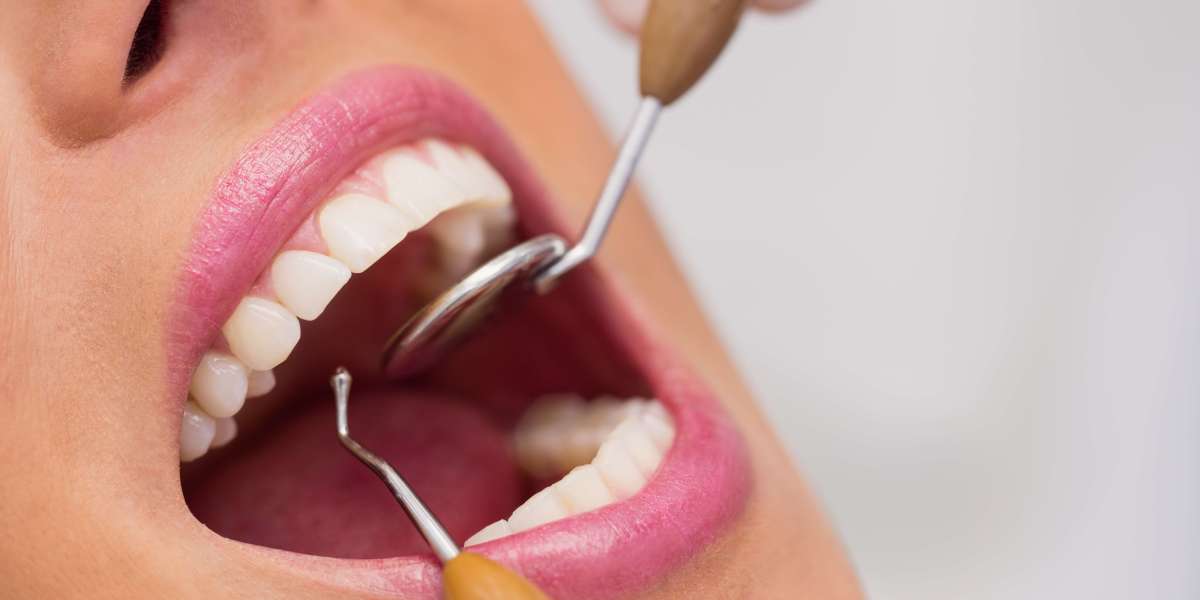A Complete Guide to Root Canal Treatment: Costs, Side Effects & What to Expect in South East London
