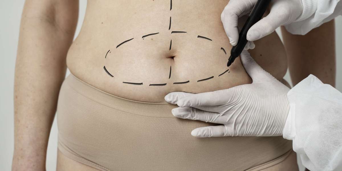 Best Liposuction in Dubai with Top Female Plastic Surgeon