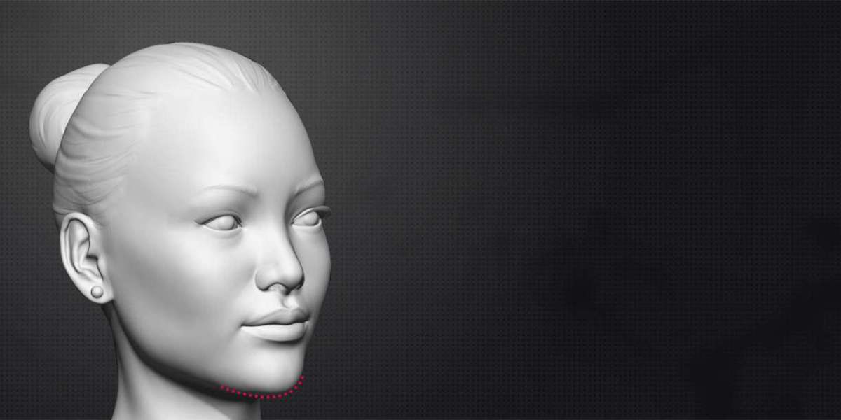 What to Avoid After Chin Feminization Surgery