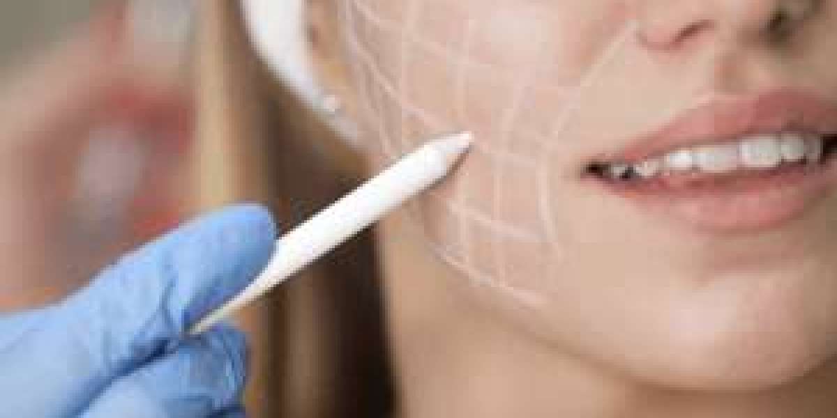 Cheek Fillers in Dubai: Lift and Sculpt Without Surgery