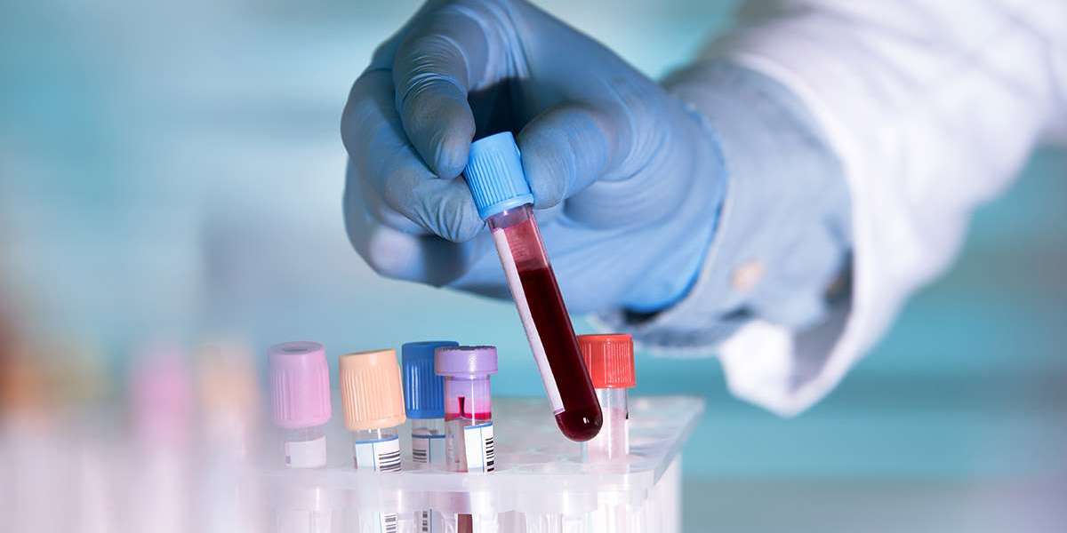 Fecal Occult Testing Market Size, Share & Competitive Analysis Report 2025–2033