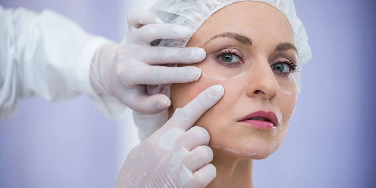Thread Lift in Delhi: The Non-Surgical Way to a Youthful Look