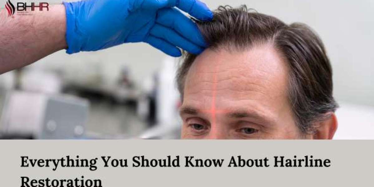 Everything You Should Know About Hairline Restoration