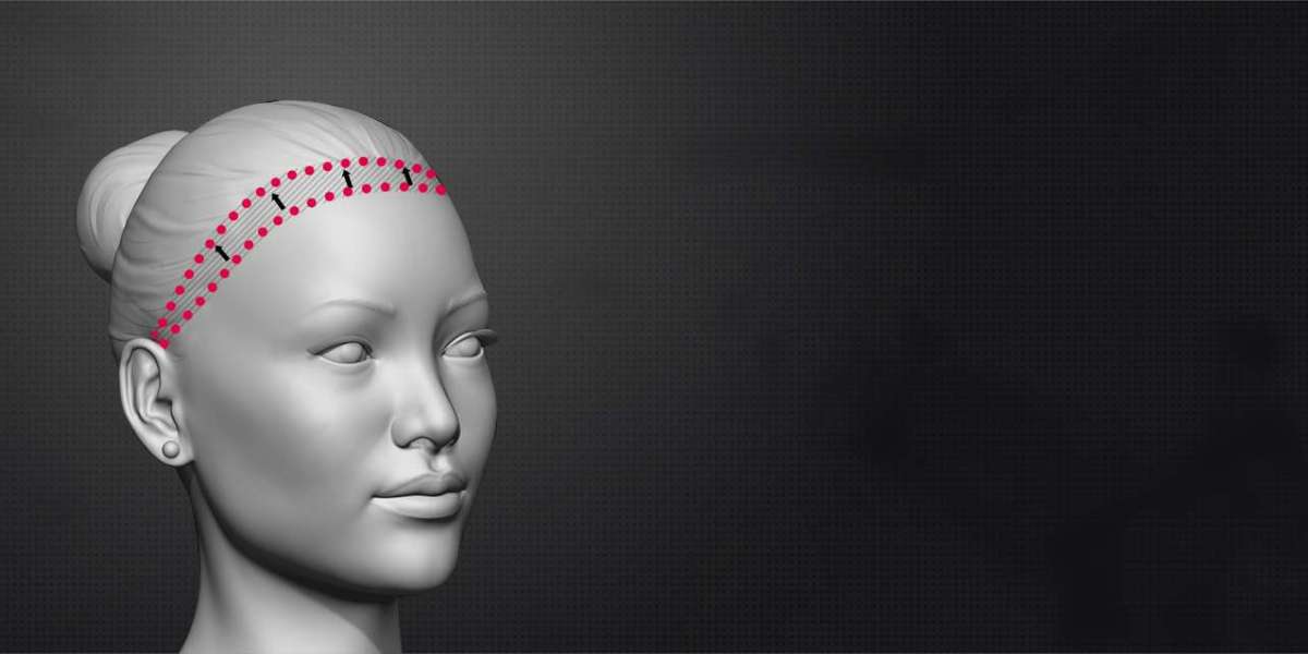 What Changes Can One See After Forehead Feminization Surgery?