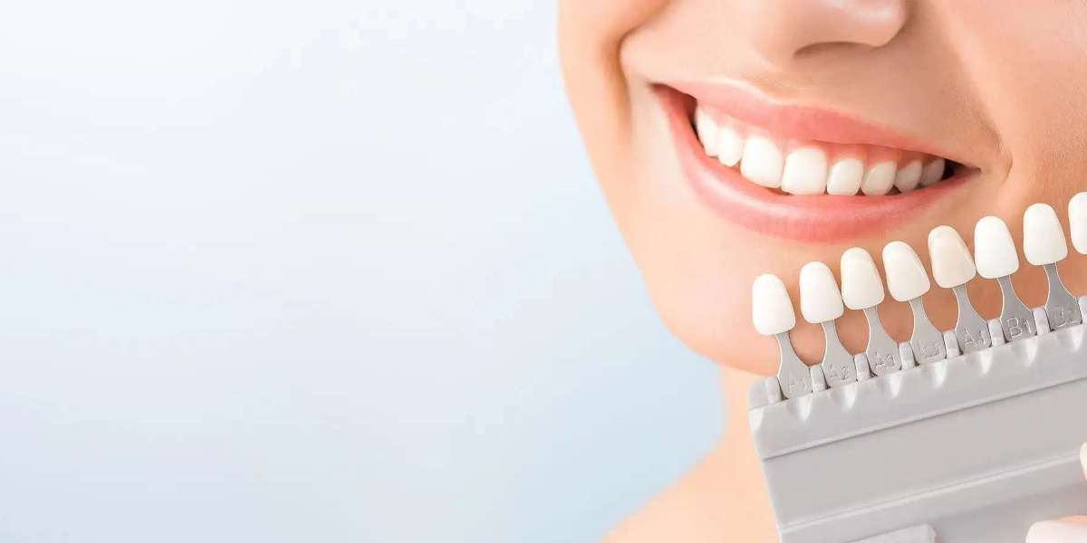 Cosmetic Dentistry: What It Is and Why It’s Gaining Popularity