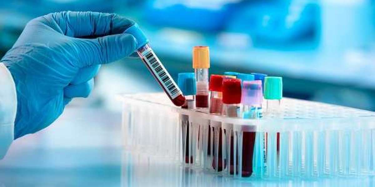 Navigating the Future of Diagnostics: Clinical Laboratory Tests Market Analysis