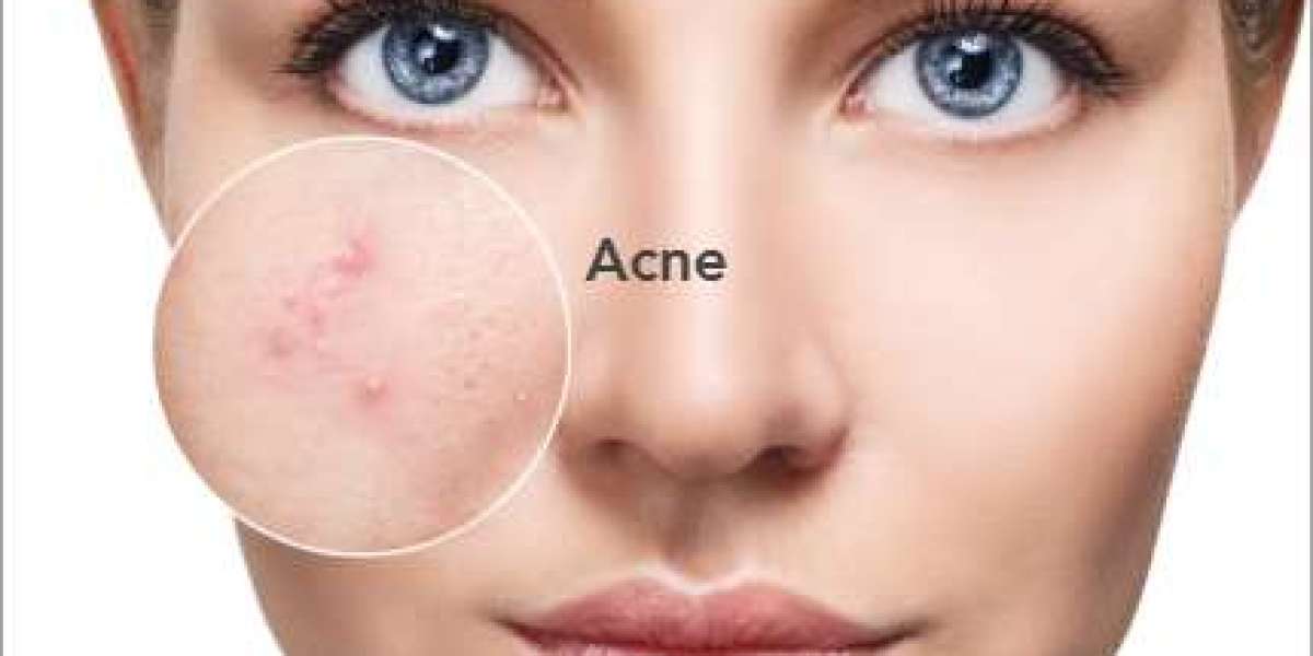 Calgary Cosmetic Dermatologist – Elevate Your Skin With Expert Care