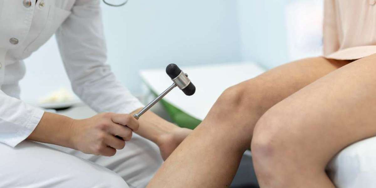 Understanding Spider Vein Treatment in San Antonio, USA