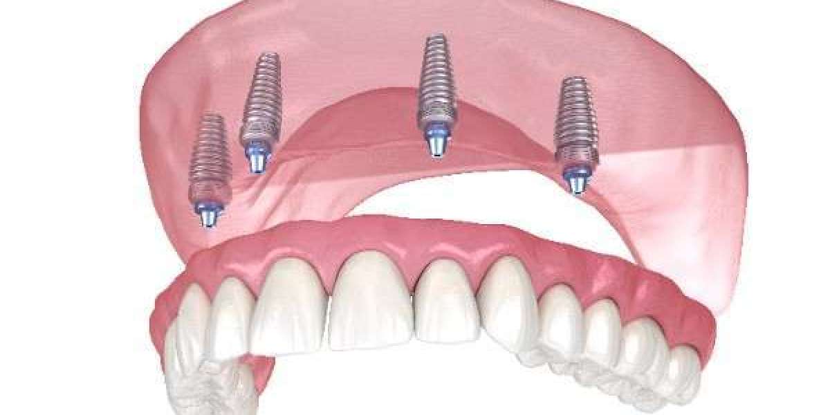 How Smile Solutions Are Changing Lives in Newcastle