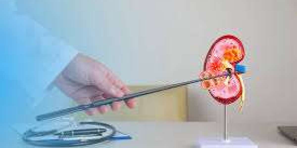 Choosing the Best Hospital for Kidney Stone Treatments