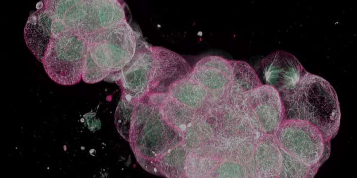 Unlocking the Potential of iPSC-Derived Neural Cells: A New Era in Regenerative Medicine