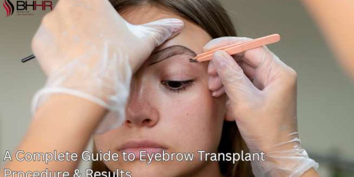 A Complete Guide to Eyebrow Transplant Procedure & Results