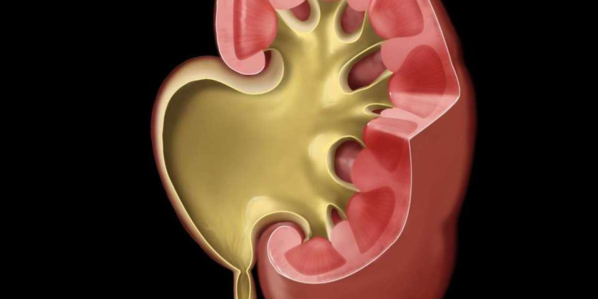 Ureteral Obstruction: Causes, Symptoms & Treatment