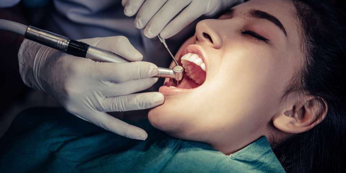 What Is Periodontal Surgery? A Complete Guide for Patients in Hounslow