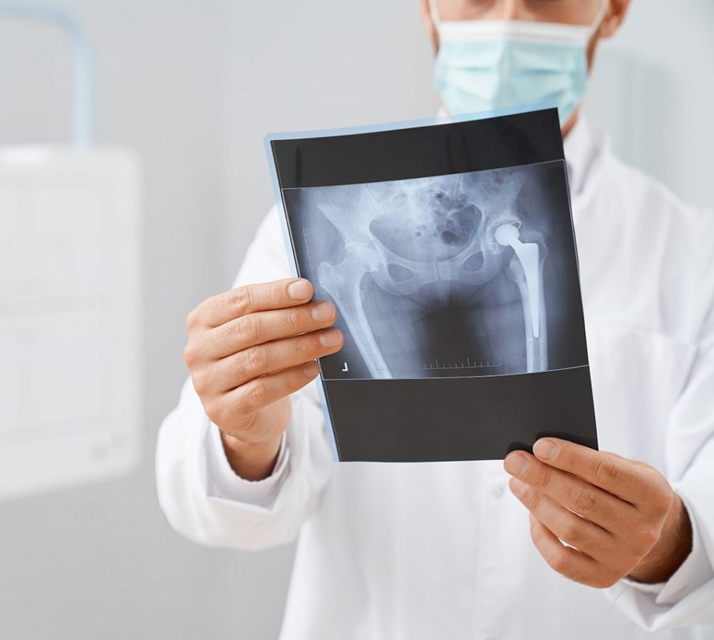 Calgary Hip and Knee Clinic, Private Surgery Alberta: Expert Care and Faster Recovery Options – Surgical Solutions Network