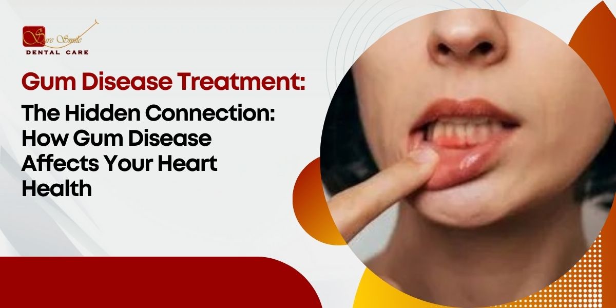 Gum Disease Treatment: Hidden Connection to Heart Health