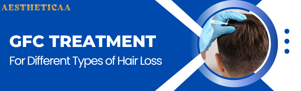 GFC Treatment for Different Types of Hair Loss - Aestheticaa