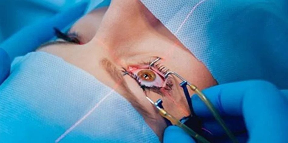 Best Lasik Eye Surgery Clinic in Faridabad