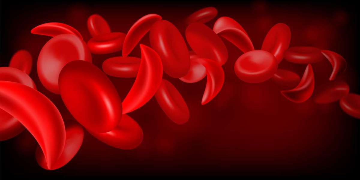 Understanding Sickle Cell Anemia and Treatment Options in India