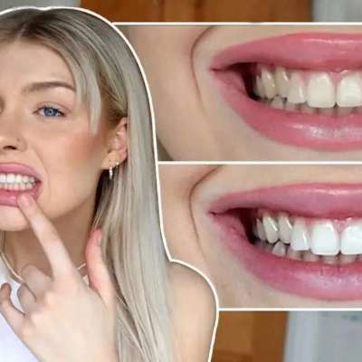 Crest Whitestrips Profile Picture