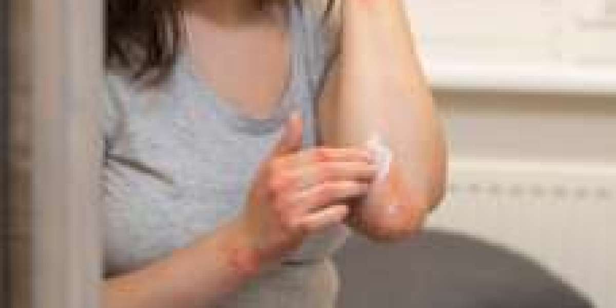 Exploring the Effectiveness of Salt Water on Keloid Scars
