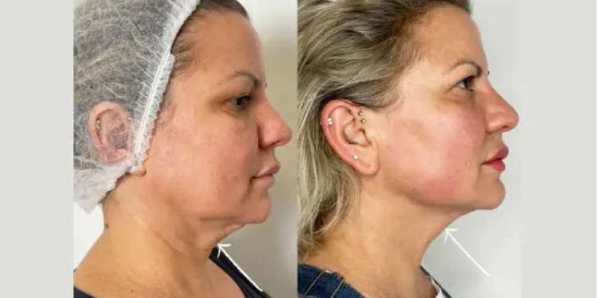 Why Perfectdrs is Home to the Best Doctors in Dubai for Advanced Treatments