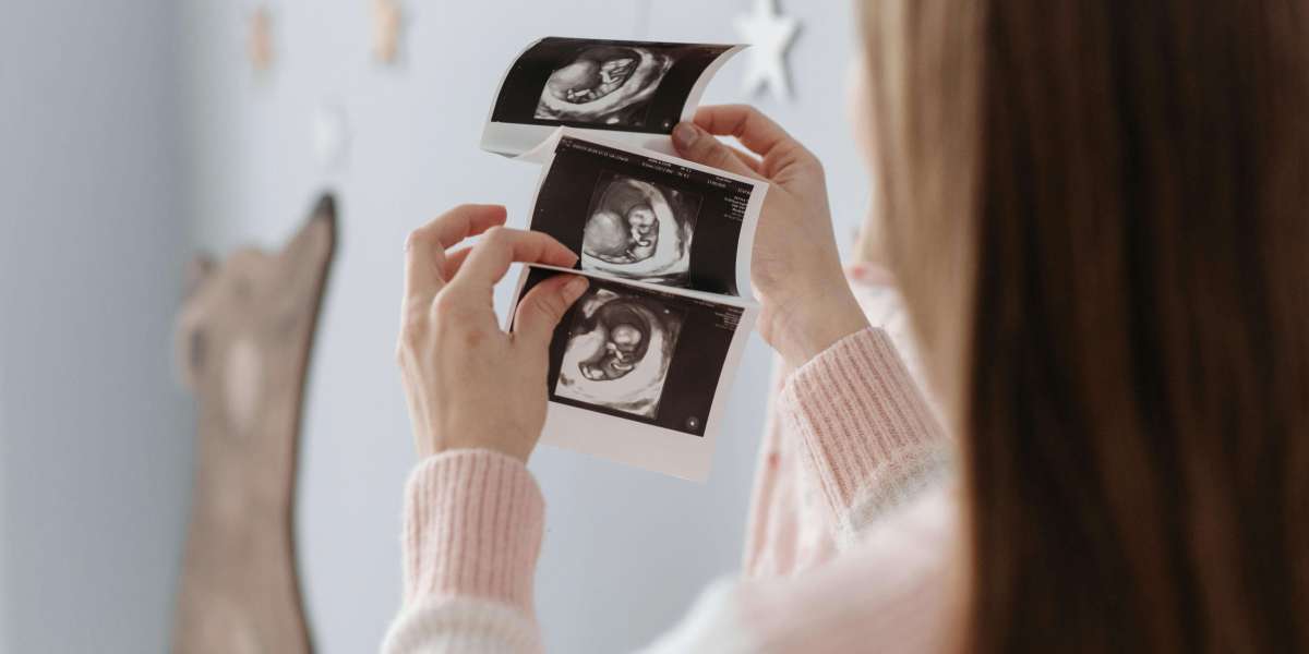 3D Ultrasound Katy: Creating Special Pregnancy Memories