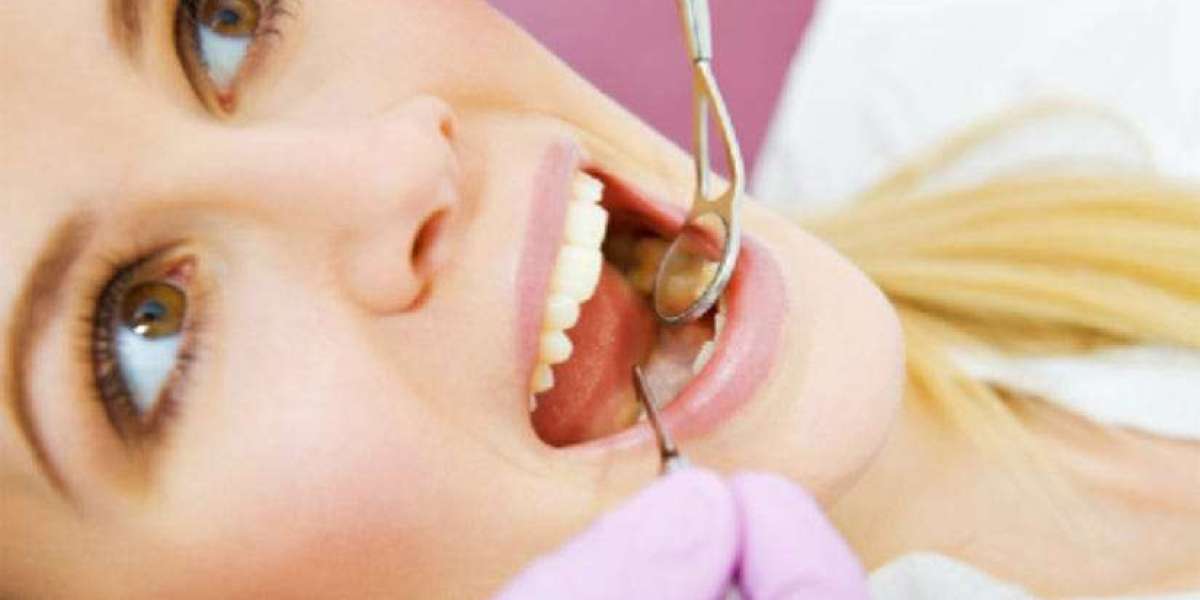 Why Root Canal Treatment Is the Best Way to Save Your Natural Tooth