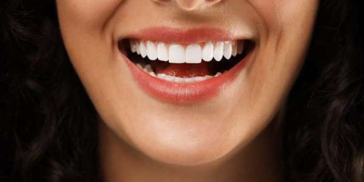 How Smile Solutions Are Changing Lives in Newcastle