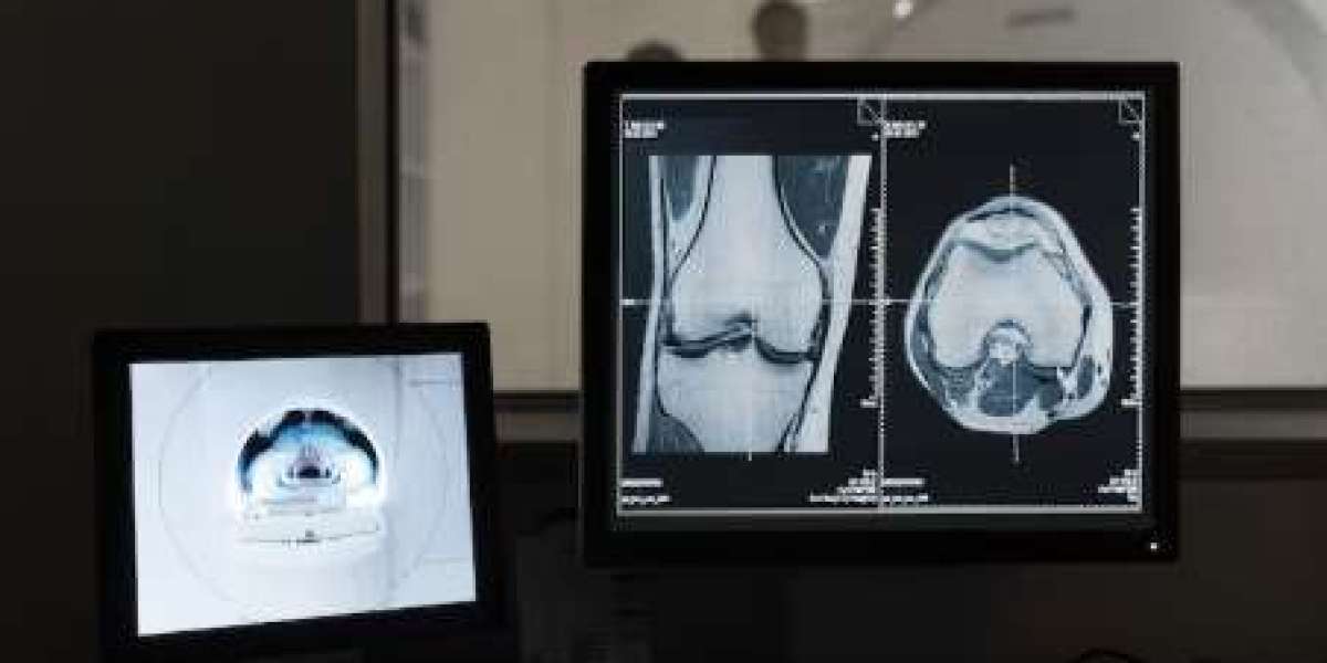대한민국 디지털 X-ray 시장 규모, 점유율 및 트렌드 보고서 (2025-2033)