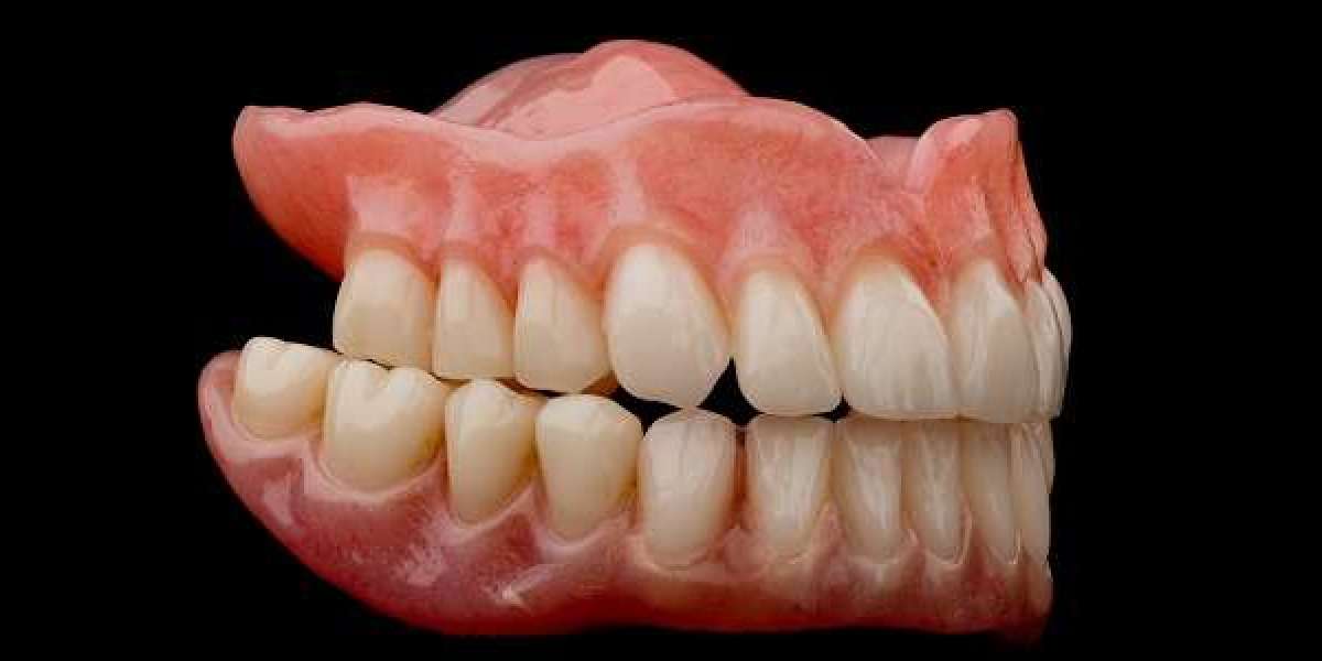 Permanent Denture Implants in Nampa, ID: A Complete Guide to Restoring Your Smile