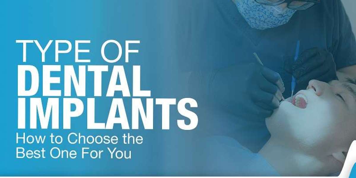 Transform Your Smile with Expert Dental Implants in Gurgaon at Ministry of Smile