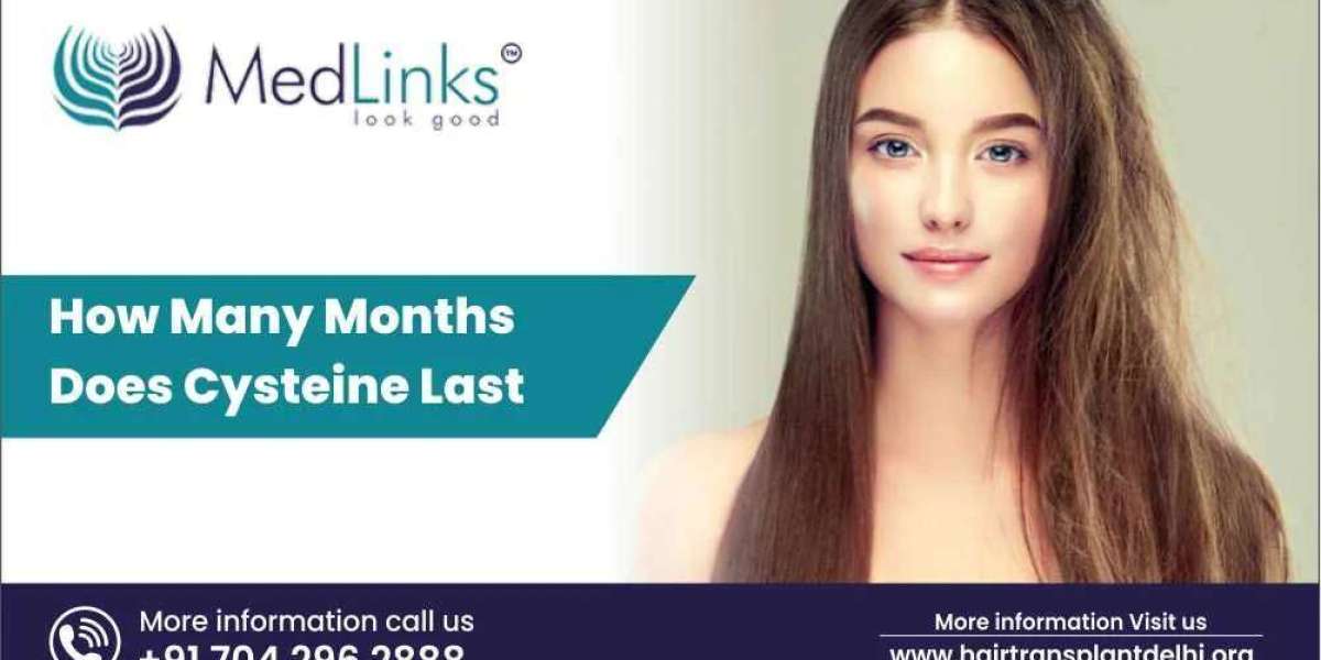 Best hair transplant in noida