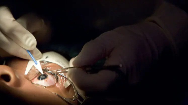 How Refractive Laser Eye Surgery in Faridabad Can Improve Your Vision