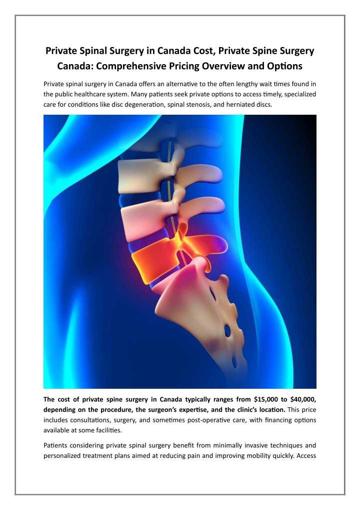 PPT - Private Spine Surgery Canada - Comprehensive Pricing Overview and Options PowerPoint Presentation - ID:14453643