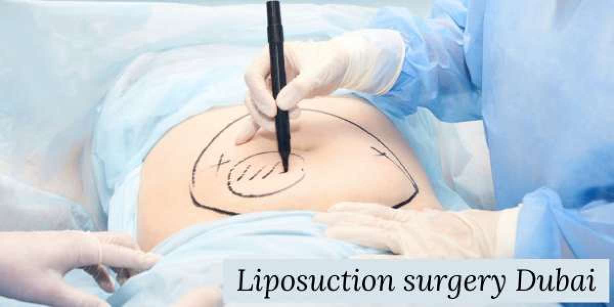Liposuction Surgery in Dubai – Cost, Procedure, and Benefits