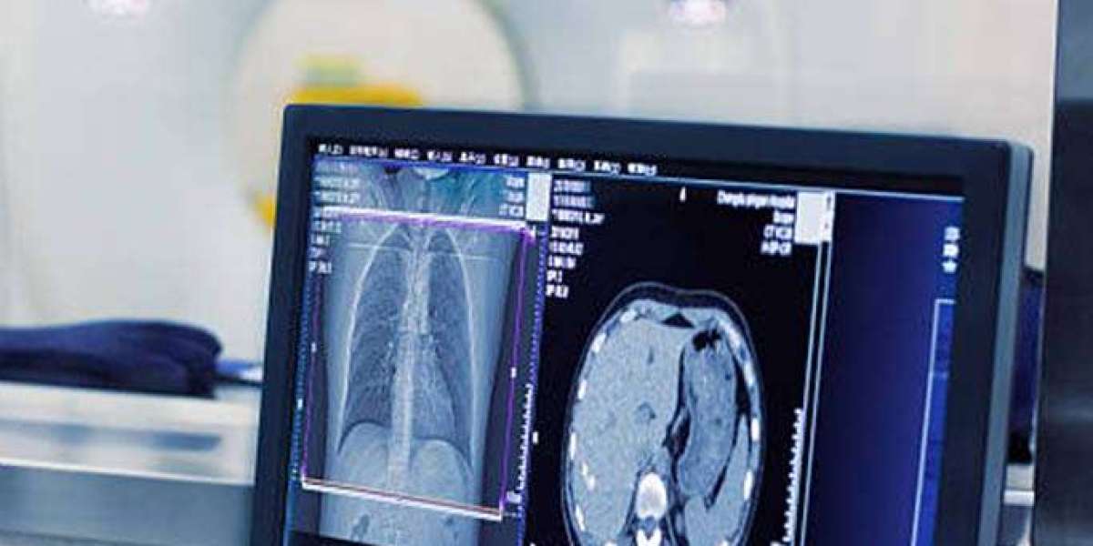 The Importance of an X-ray Machine for Chiro Office