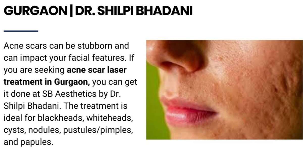 Complications Associated with Acne Scar Laser Treatment Options