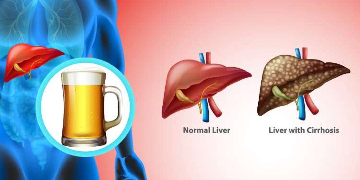 Alcohol and Liver Health: What Everyone Should Know