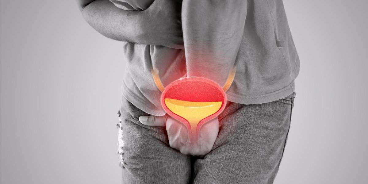 Kidney Stone Treatment in Jaipur: Causes, Symptoms, and Advanced Solutions