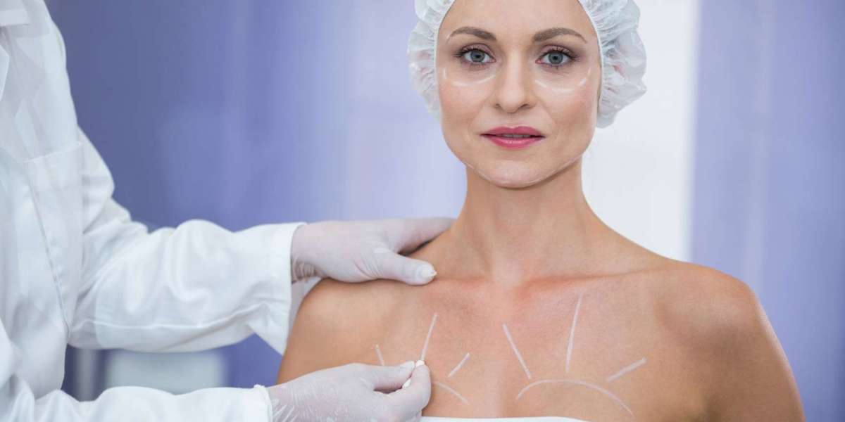 Breast Reduction Surgery by the Best Plastic Surgeon in Dubai