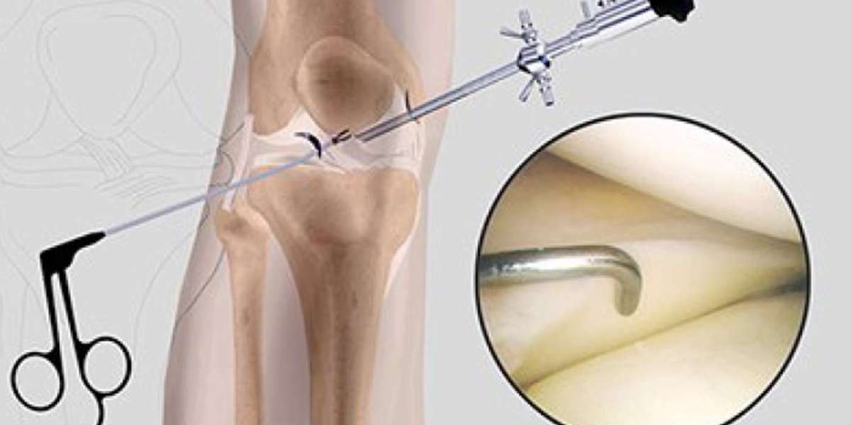 Arthroscopy Devices Market Opportunities Driven by Technological Innovation, Rising Procedures, and Emerging Regional Gr