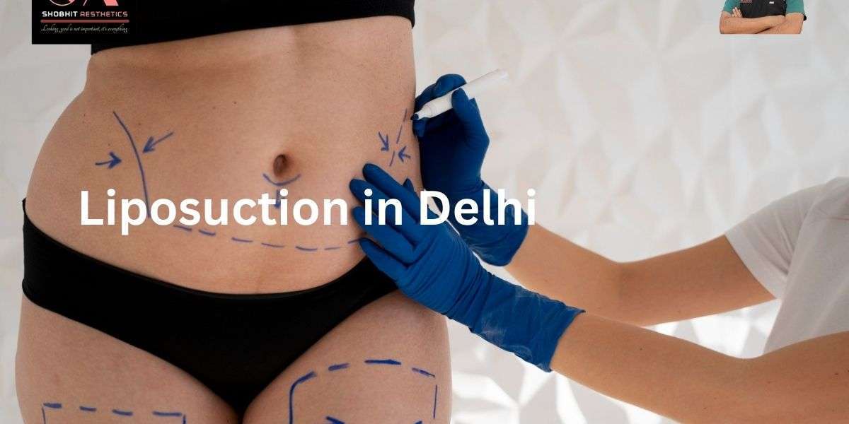 Who is the Best Liposuction Surgeon in Delhi?