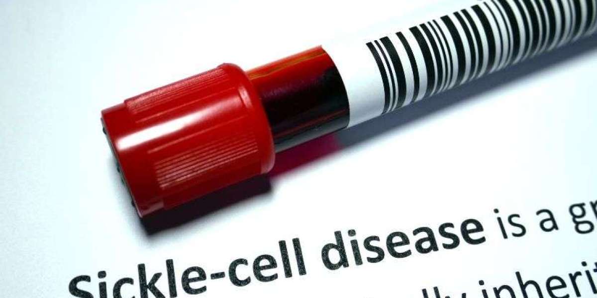 Sickle Cell Disease Treatment Market: A Comprehensive Overview